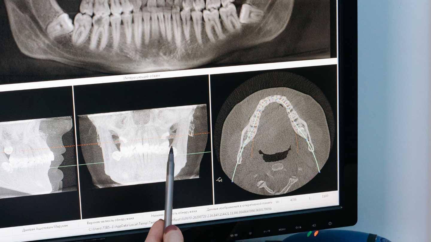 radiografie