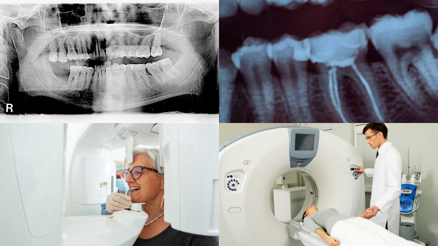 radiografie dentara